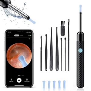 Ear Wax Removal Tool, Ear Cleaner Otoscope with Light, Ear Cleaning Kit with 8 Pcs Ear Set, Earwax Removal Kit with 6 Ear Pick, Ear Camera for iPhone, iPad, Android Phones